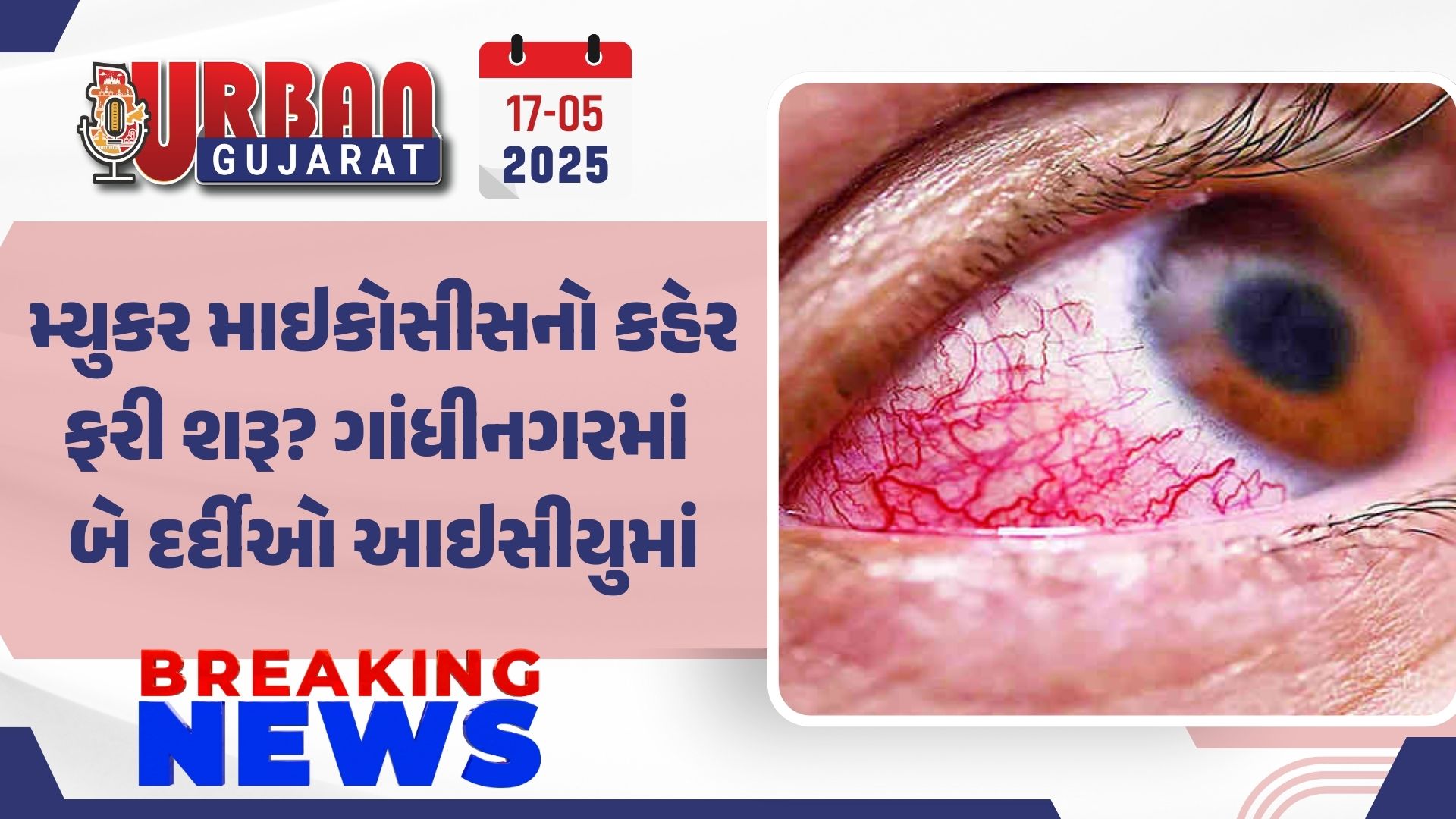 મ્યુકર માઇકોસીસનો કહેર ફરી શરૂ? ગાંધીનગરમાં બે દર્દીઓ આઇસીયુમાં