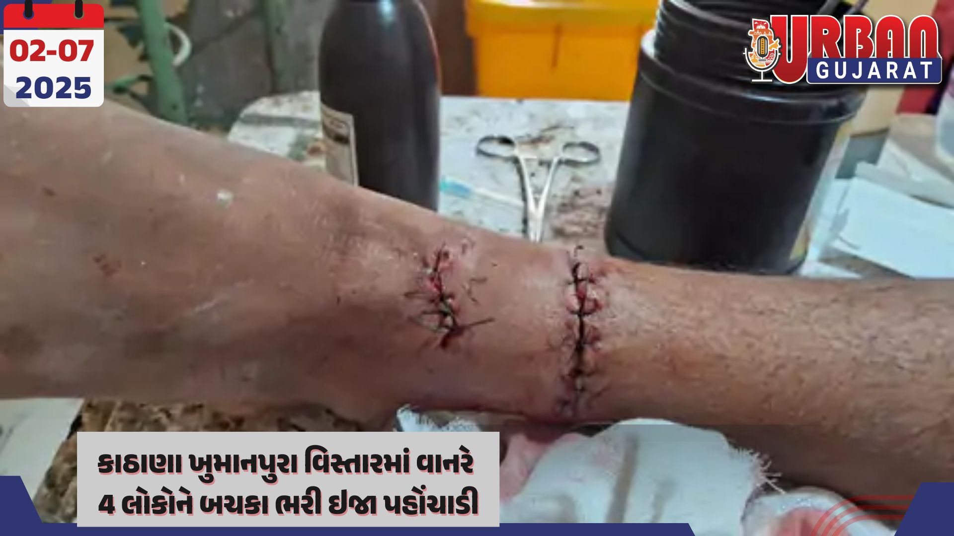 કાઠાણા ખુમાનપુરા વિસ્તારમાં વાનરે 4 લોકોને બચકા ભરી ઇજા પહોંચાડી