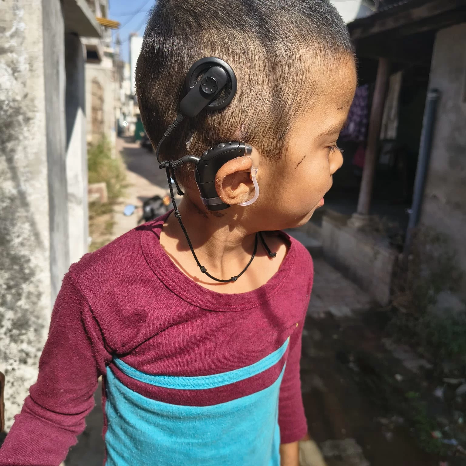 RBSK યોજનાનો ચમત્કાર: આણંદના ૩ વર્ષના કુંજને મળી નવી વાચા, ₹૭ લાખનું ઓપરેશન ફ્રીમાં થયું